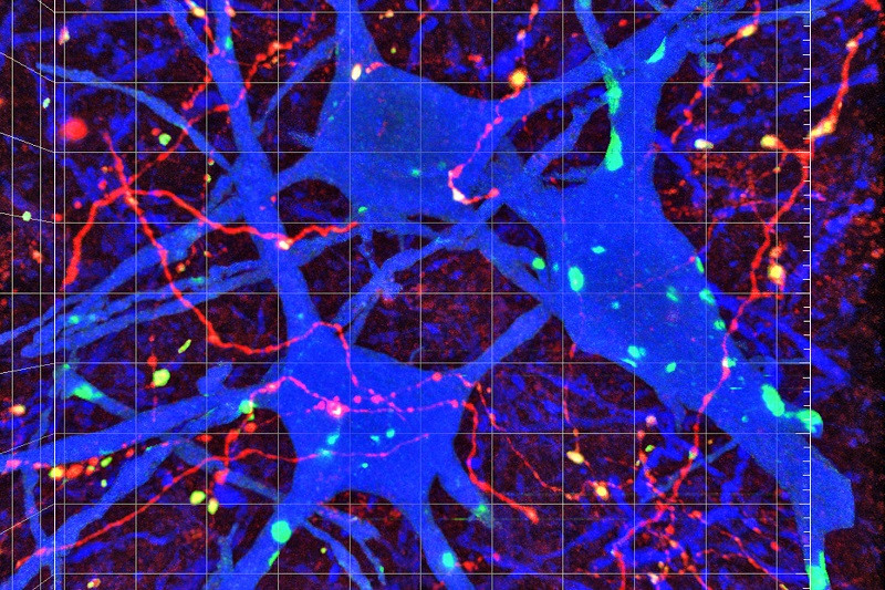 نقشه اتصالات عصبی مغز و نخاع تدوین شد